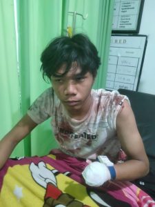 Dikeroyok, Tangan Remaja Ini Putus Ditebas Parang