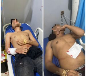 Dua Anggota Polda Sultra Ditikam OTK Di Depan Hotel Di Kendari